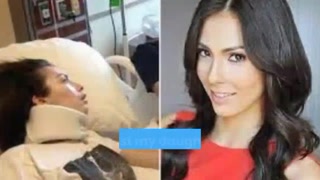 Model Chantel Giacalone Brand Damaged After Eating Pretzel